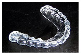 Night time mouthguard to solve teeth grinding from Mullenbach Dentistry
